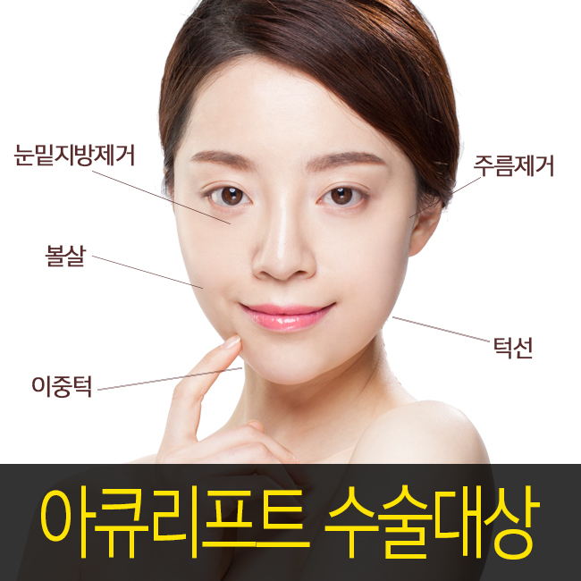 얼굴살흡입으로 V라인이 가능 :: 김형진뉴라인성형외과 관련 이미지 3