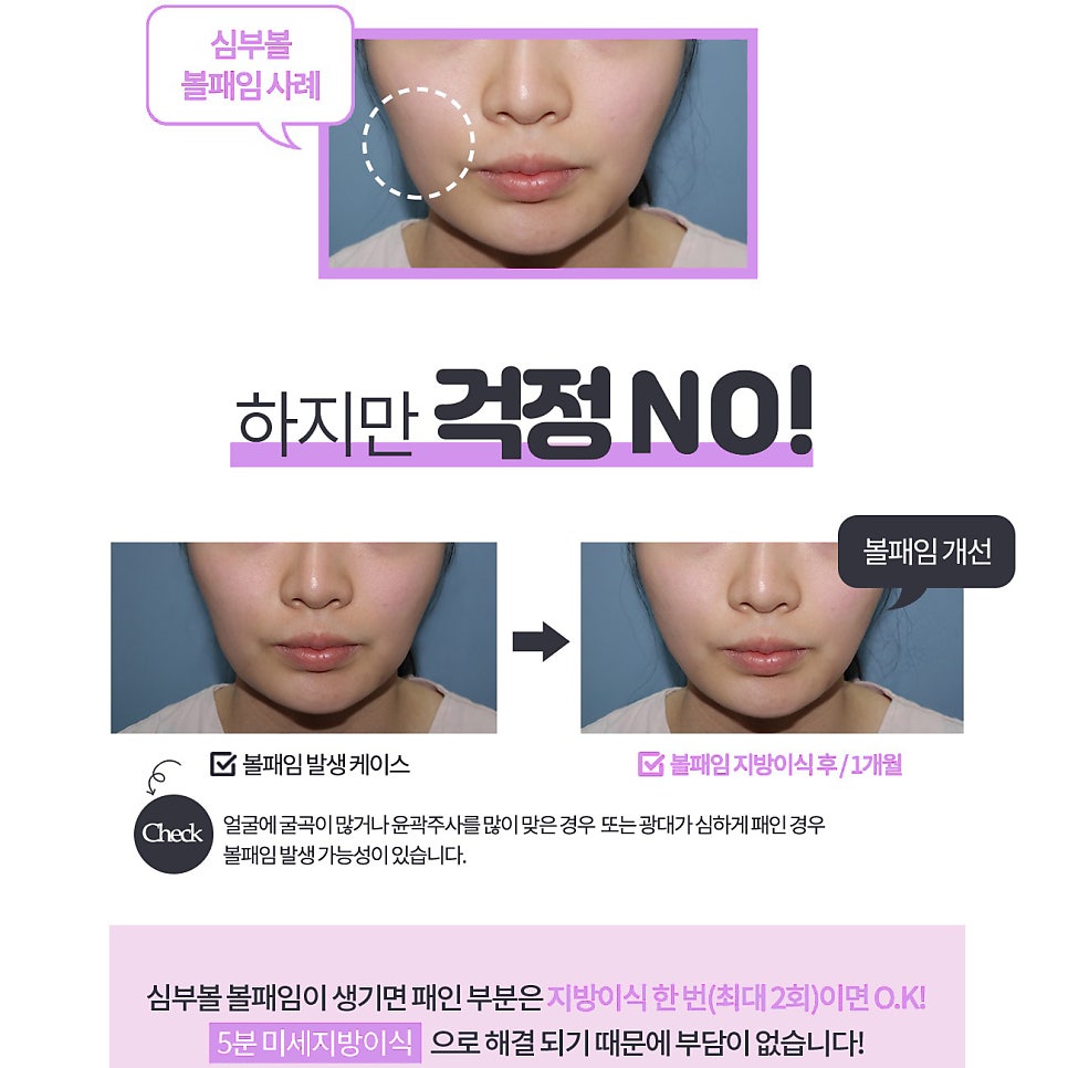 빠르게 볼살빼는법 이것만 알면 쉬워집니다 관련 이미지 5