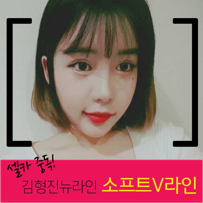 얼굴V라인 때문에 셀카중독! 관련 이미지 3