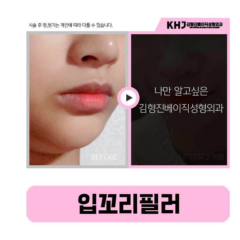 하루 만에 입꼬리올리는법 보고 가실래요? 관련 이미지 5