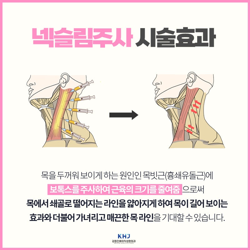 신부관리 넥슬림주사로 슬림하고 긴 넥 라인 완성해요! 관련 이미지 3