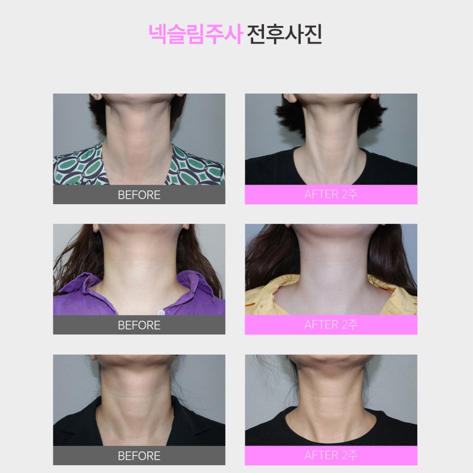 목라인관리는 여기서 하기로 마음 굳혔어요! 관련 이미지 5