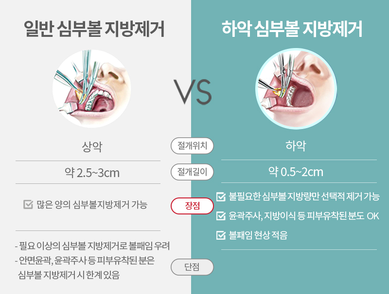 왜 하악심부볼이냐면요. 관련 이미지 3