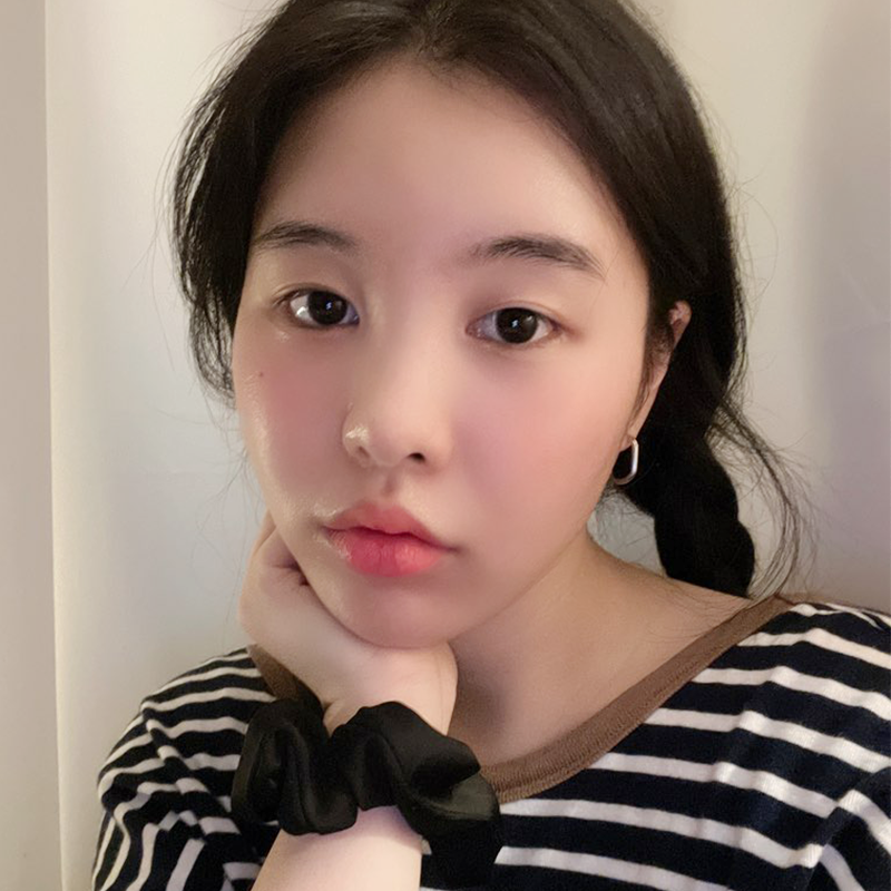 이중턱지방흡입잘하는곳 김형진베이직! 관련 이미지 3