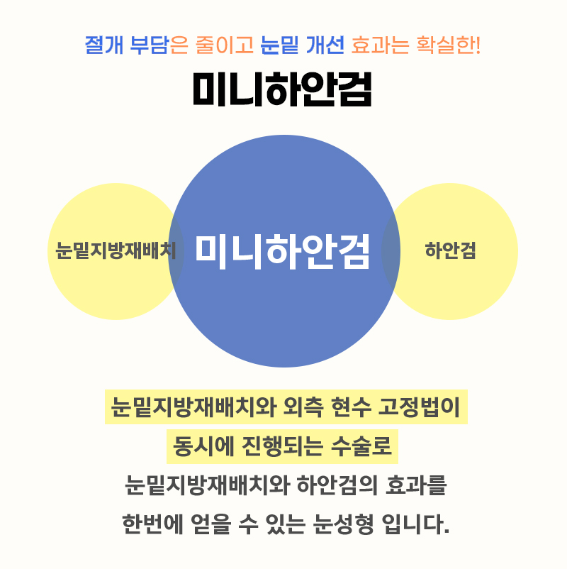 중년수술, 미니하안검후기 보고 결정하세요! 관련 이미지 3