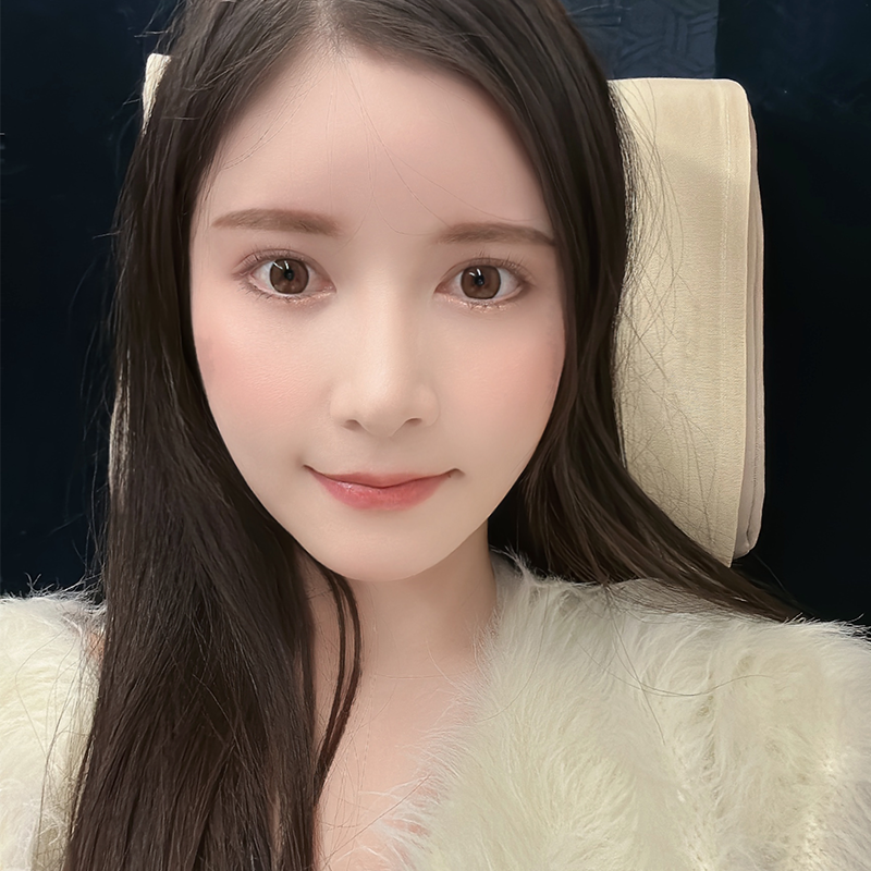 눈밑지방재배치붓기 적을 수밖에 없는 이유 관련 이미지 4