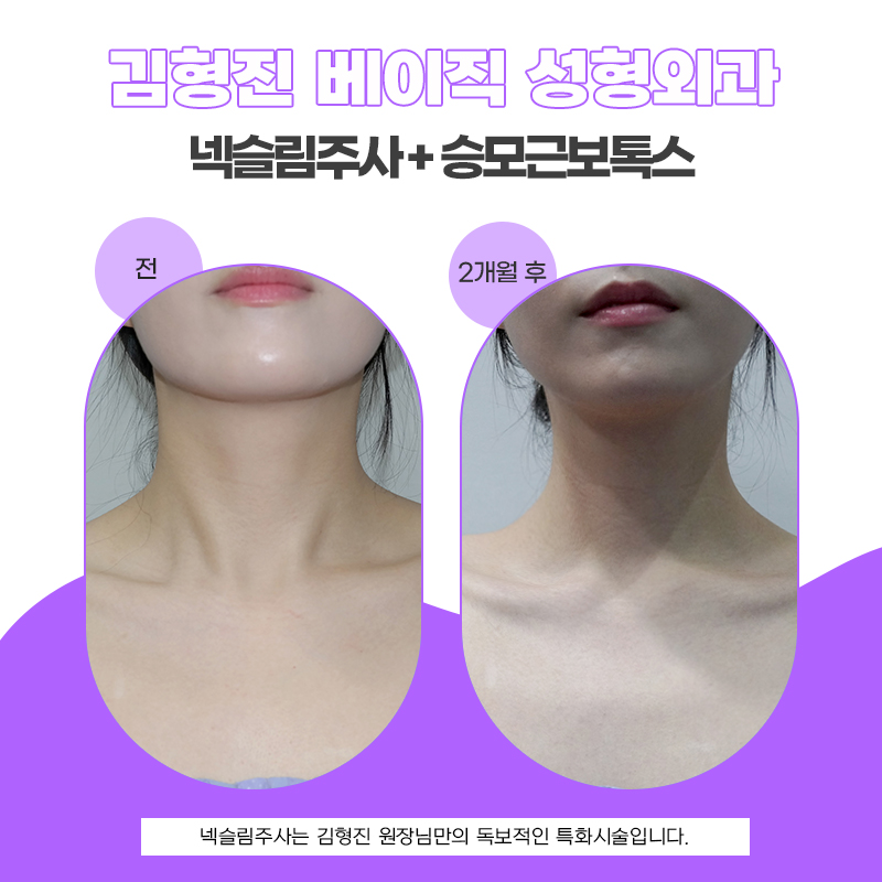 목얇아지는법? 목 선부터 어깨 선까지 완성하는 시크릿 케어! 관련 이미지 5