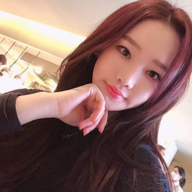 재발없는 눈밑지방재배치수술은 김형진베이직이 유일해요! 관련 이미지 2