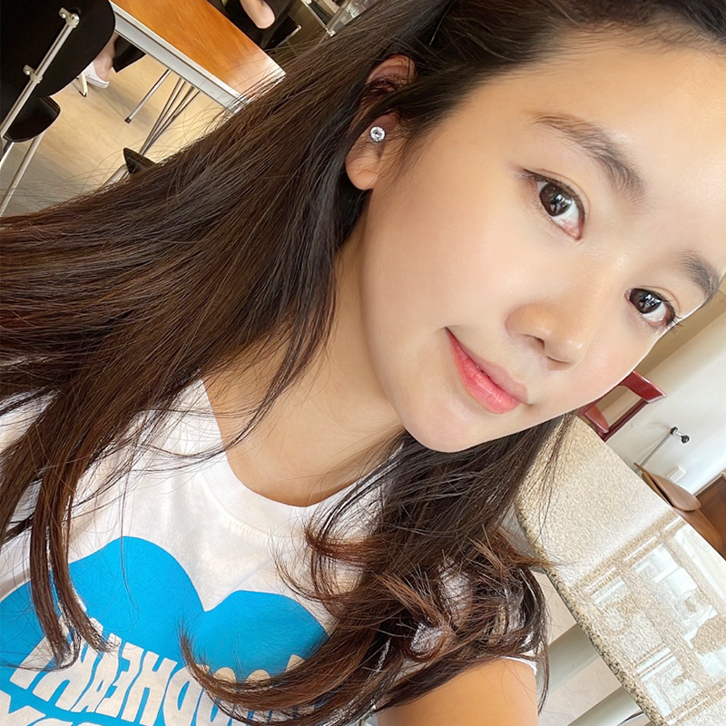 얼굴지방흡입비용 저렴한 곳보다는 잘하는 곳에서 하셔야죠 관련 이미지 2