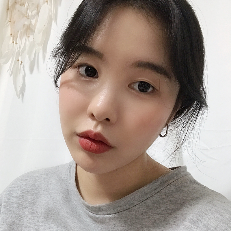 침샘보톡스전후 궁금하시다구요? 관련 이미지 1