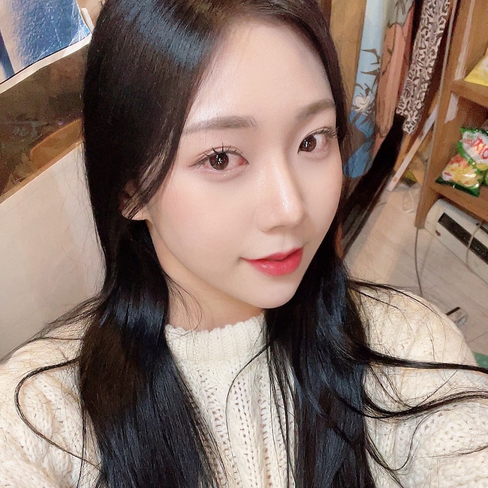 입꼬리필러전후 보고 여기로 마음 굳혔어요! 관련 이미지 2