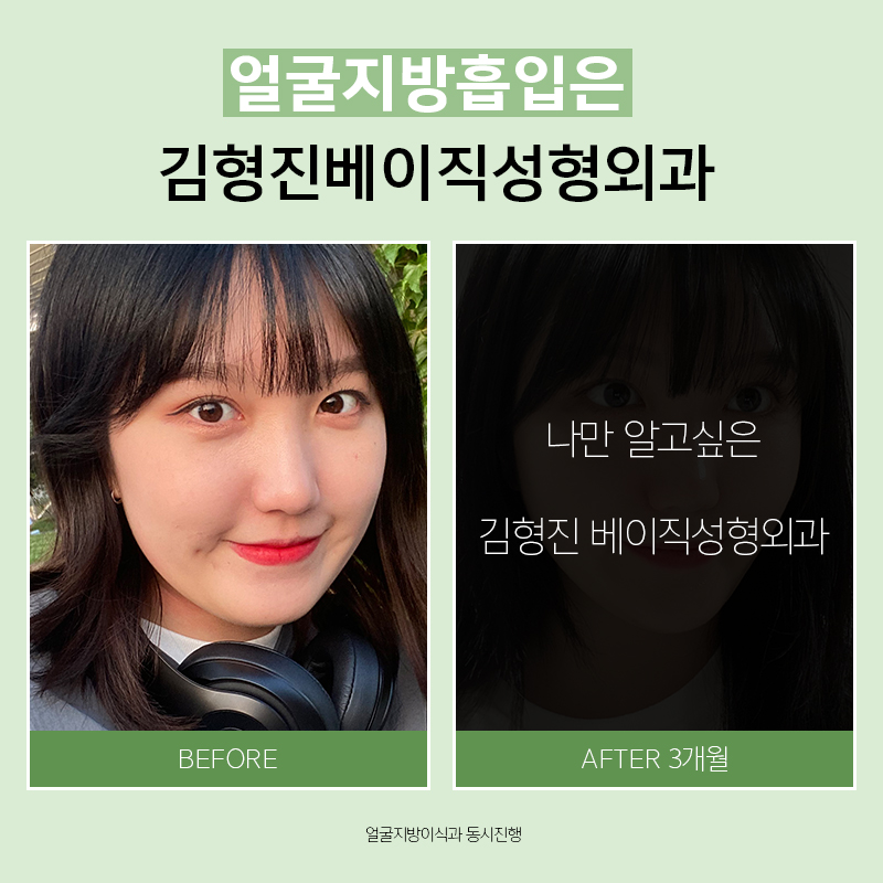 갸름한얼굴라인만드는법 쉬워요! 관련 이미지 7