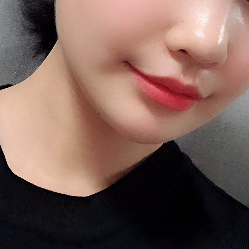 너무 쉽게 입꼬리올리는법 김형진베이직에서 알려드려요! 관련 이미지 2