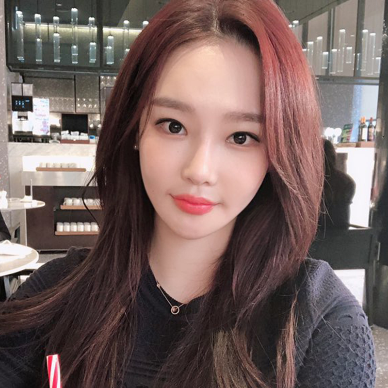 눈밑지방재배치유지력 오래가는 곳 찾으신다면? 관련 이미지 3