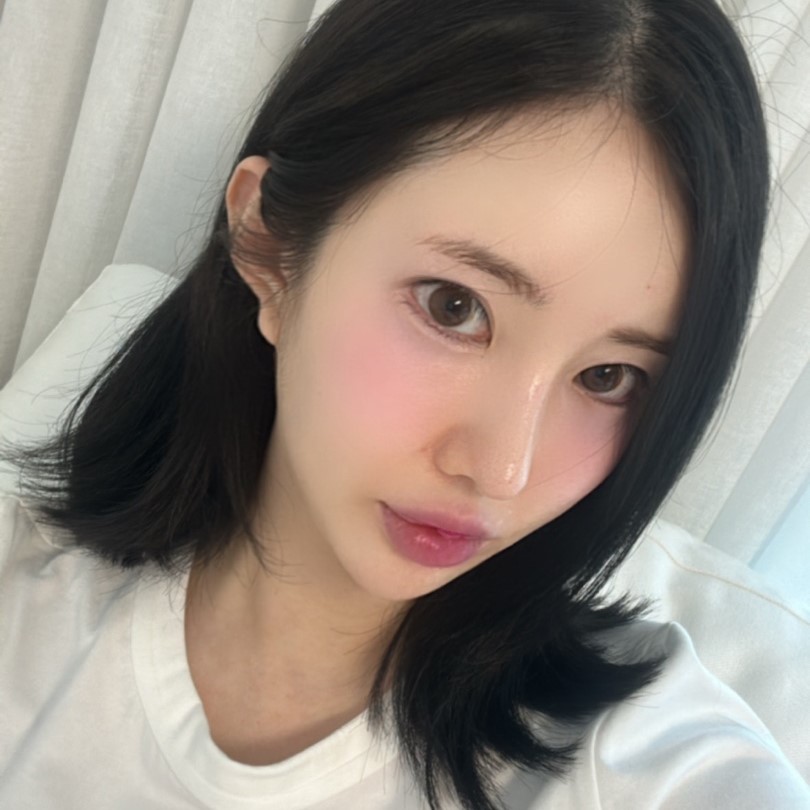 눈밑지방재배치부기 얼마나 가는지 궁금하다면? 관련 이미지 1