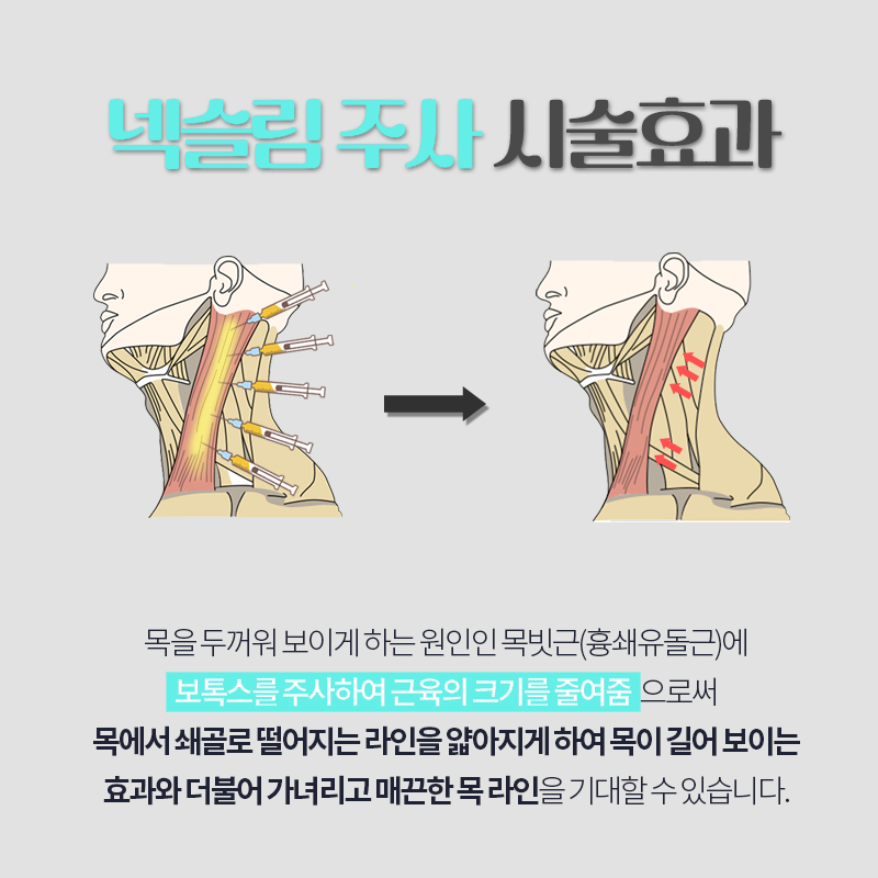 두꺼운목 넥슬림주사로 한번에 해결하세요! 관련 이미지 4