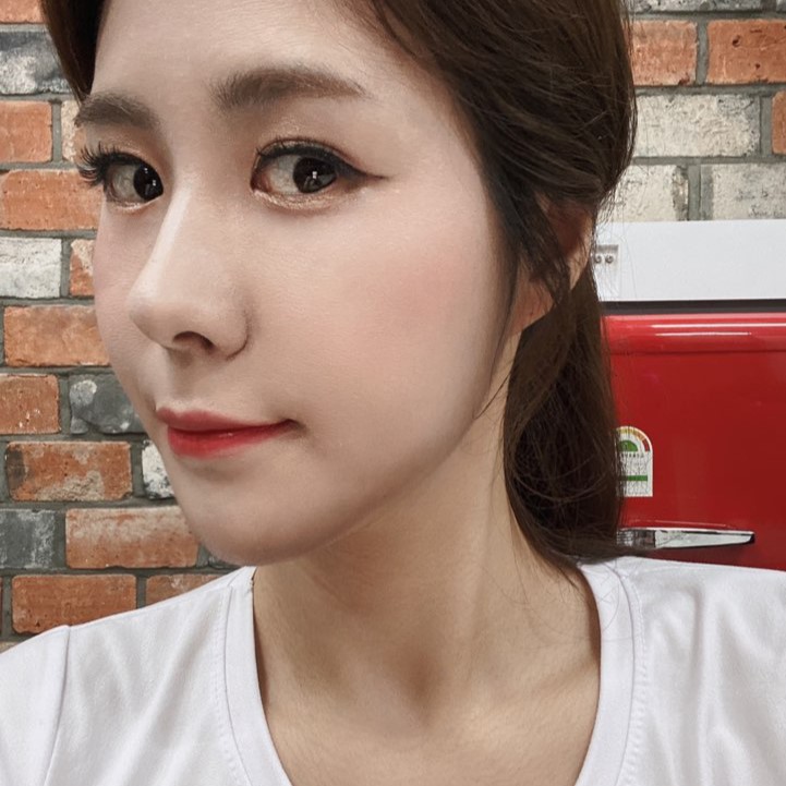 혹시 나도 물갈퀴목? 목보톡스로 해결이 되긴 하네요 관련 이미지 1