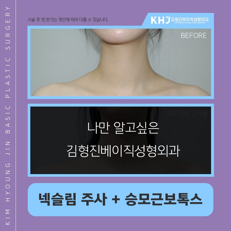 목보톡스 진짜는 김형진베이직인거 아시죠 관련 이미지 2