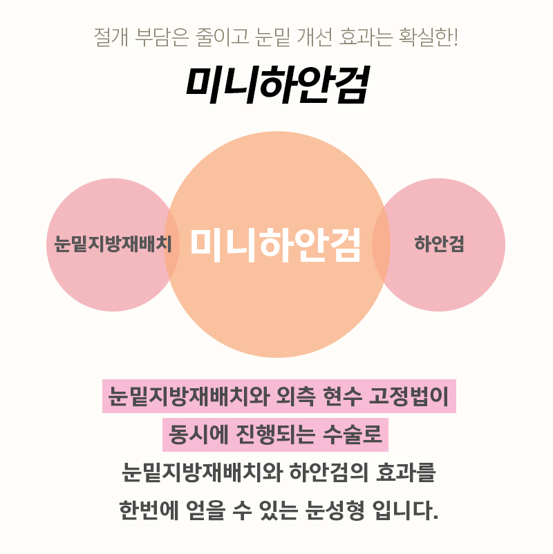 미니하안검효과 궁금하셨다구요? 관련 이미지 2