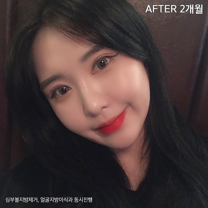 이중턱해결법 아직 모르신다구요? 관련 이미지 7