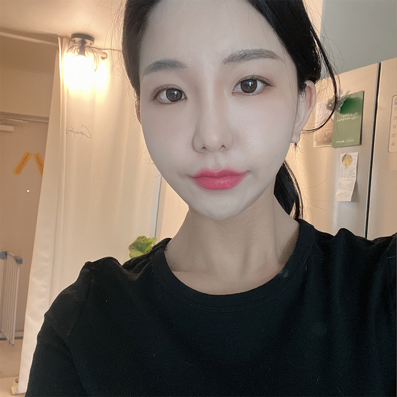 심부볼리프팅 효과 없다는 사실 아직 모르셨다면 관련 이미지 5