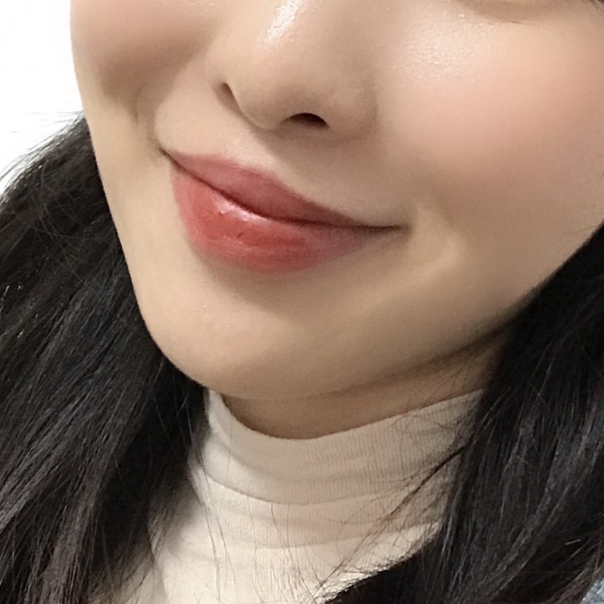 입꼬리교정을 통해 웃는 인상 완성해요 관련 이미지 2