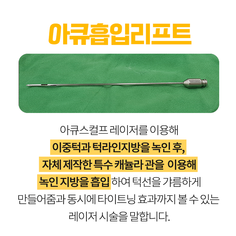 턱살지방흡입에 대해 솔직하게 다 알려드릴게요 관련 이미지 4