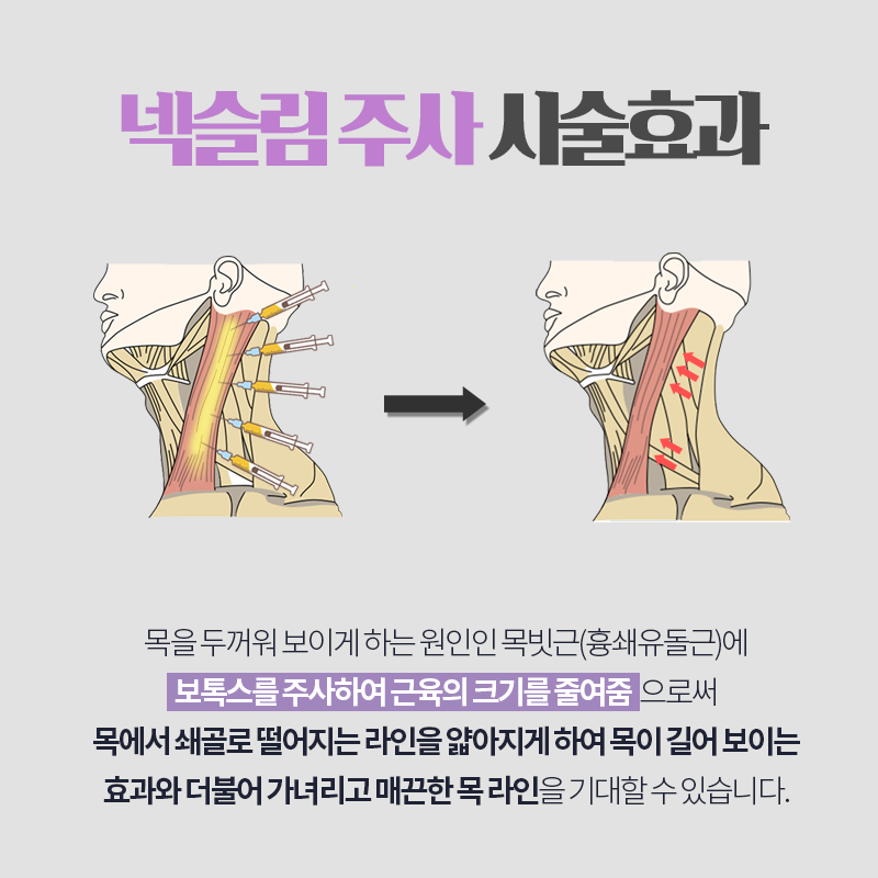 넥슬림주사시술 어디가 잘하냐면요 관련 이미지 3