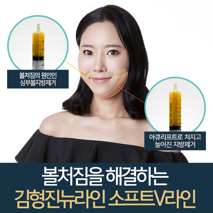 안면윤곽후볼처짐리프팅 아니야 관련 이미지 4