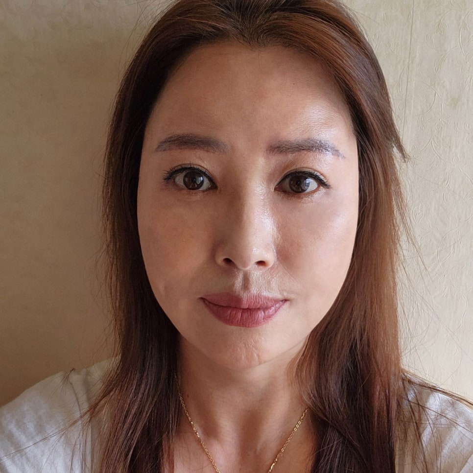 중년성형후기, 눈 밑이 조금만 달라져도 인상이 확 바뀌어요! 관련 이미지 1