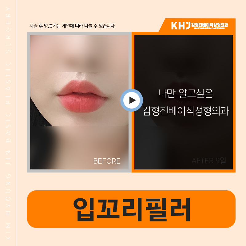 입꼬리올리는법 이거 하나만 해도 충분합니다! 관련 이미지 5