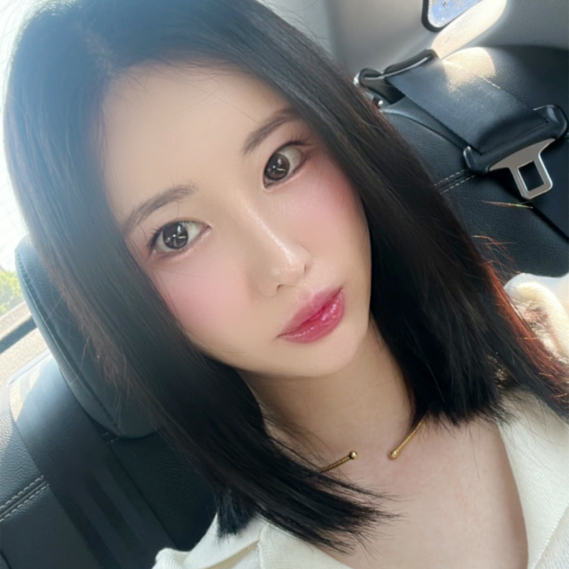 눈밑지방재배치전후 보러 오실래요~? 관련 이미지 1