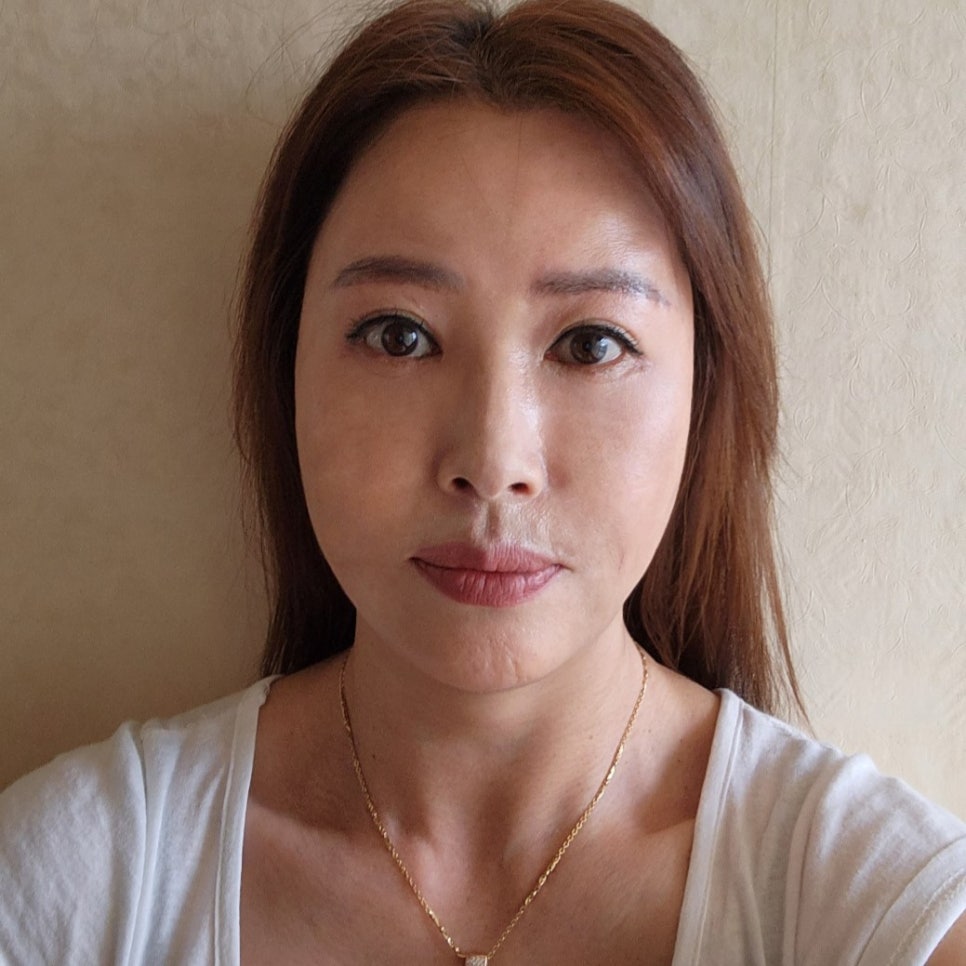 중년눈수술 걱정돼서 망설이고 있다면 관련 이미지 1