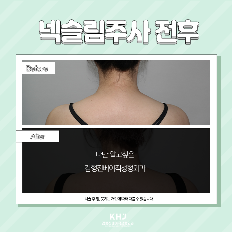 목얇아지는법 김형진베이직에는 있답니다! 관련 이미지 5