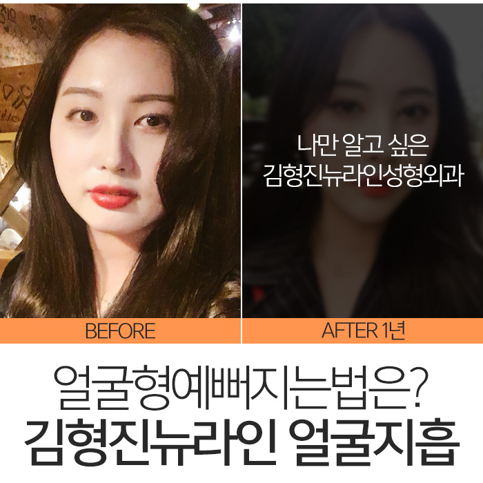 얼굴형예뻐지는법 확실한건 관련 이미지 7