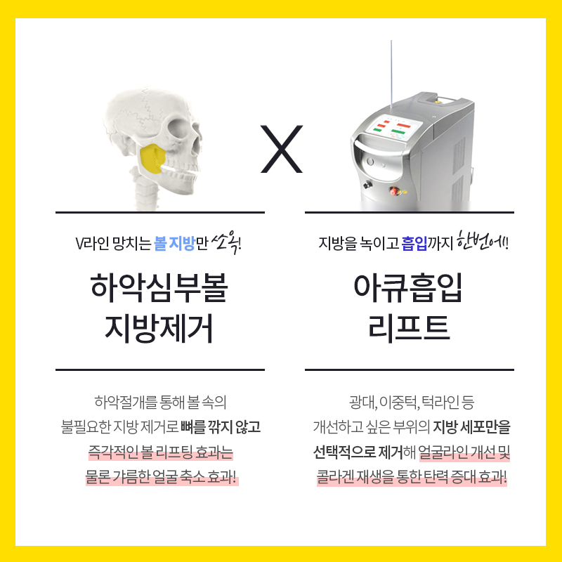 얼굴살없애는법 쉬운 길 두고 돌아가지 마세요! 관련 이미지 4