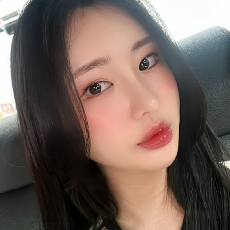 눈밑지방재배치수술 아직도 망설이신다면 관련 이미지 6