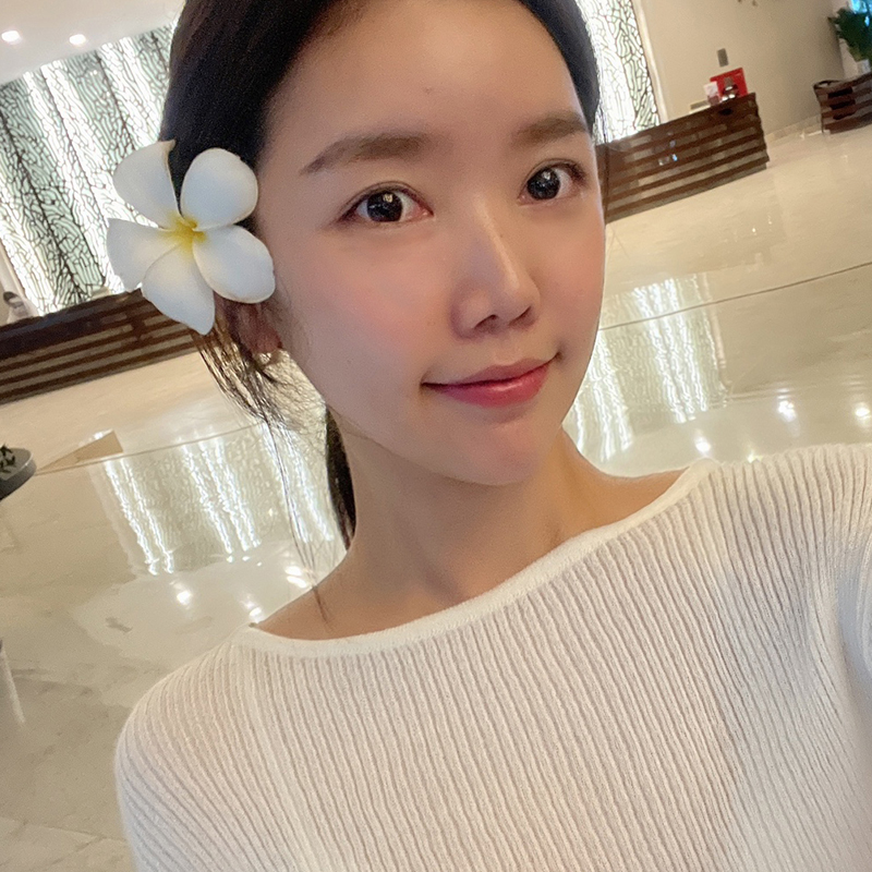 턱살흡입전후 궁금하다면 여기로! 관련 이미지 6