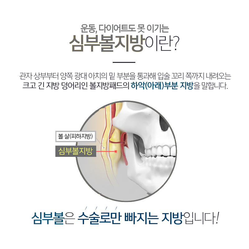 볼살없애는법 심부볼제거로 확실한 변화를 느껴보세요! 관련 이미지 4