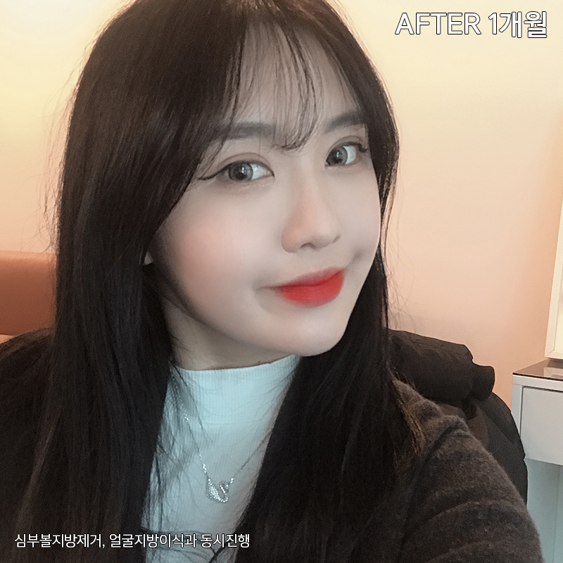 이중턱해결법 아직 모르신다구요? 관련 이미지 6