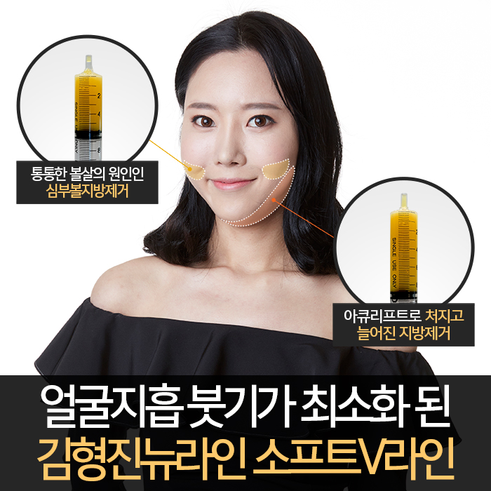 얼굴지방흡입붓기 솔직히 없을 순 없어요 관련 이미지 4