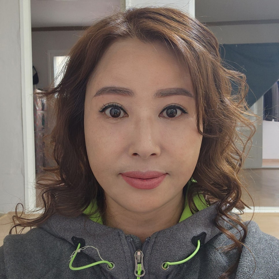 나이들어 보이는 눈, 중년눈수술 미니하안검으로 되돌려요 관련 이미지 1