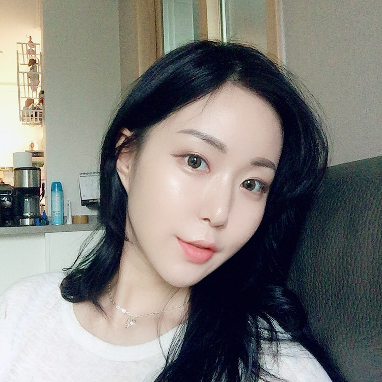 볼살제거 하고 V라인 장착하고 왔어요! 관련 이미지 1