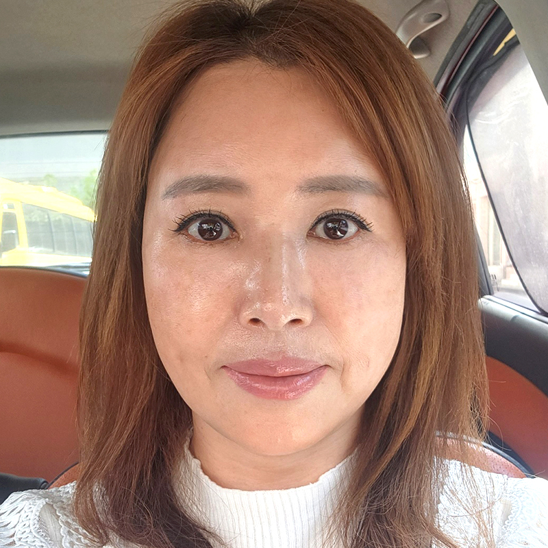 중년눈밑처짐 해결방법은 관련 이미지 1