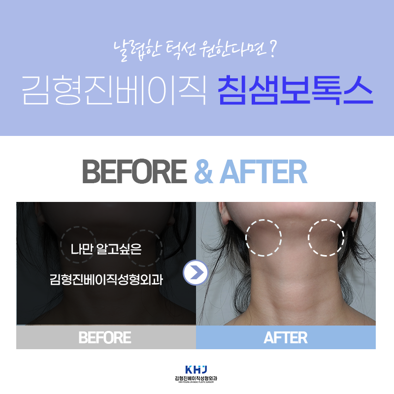 침샘치료도 역시 김형진베이직! 관련 이미지 4