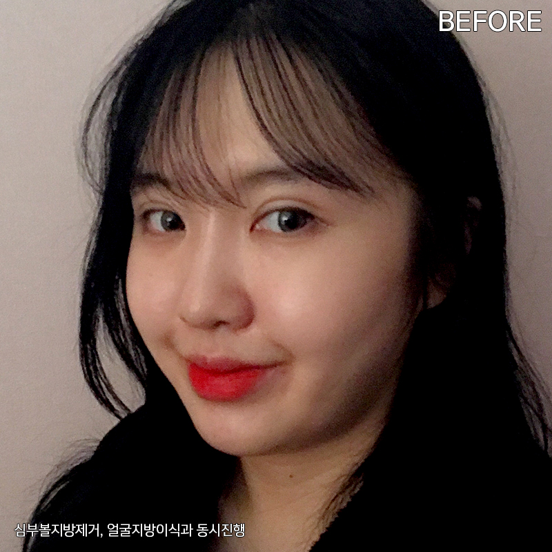 이중턱해결법 아직 모르신다구요? 관련 이미지 2