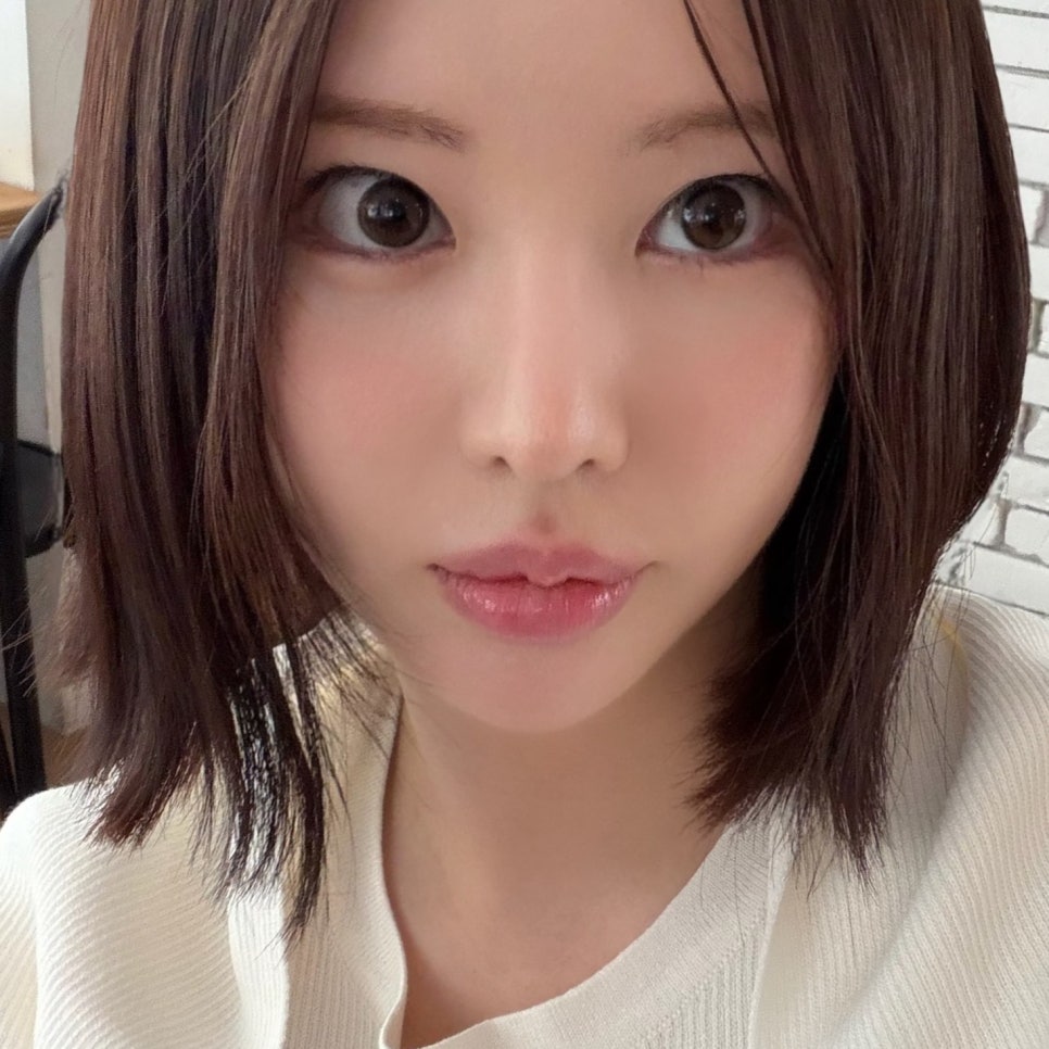 침샘보톡스전후 이중턱이랑 이별했어요 관련 이미지 3
