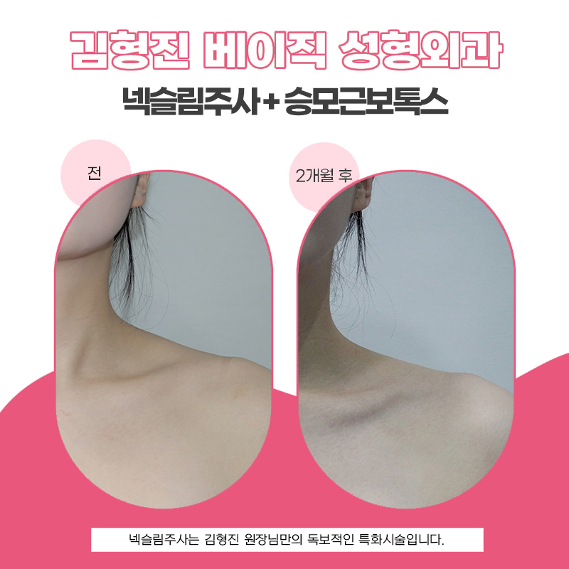 넥슬림주사후기 이보다 확실한 차이는 없을듯... 관련 이미지 5