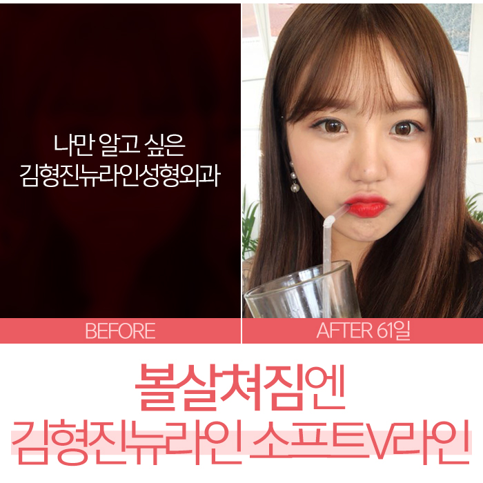 볼살쳐짐 어이 하늬? 관련 이미지 2