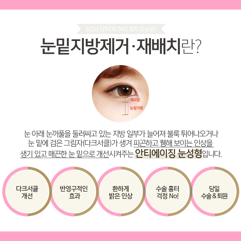눈밑지방재배치부기 얼마나 가는지 궁금하다면? 관련 이미지 4